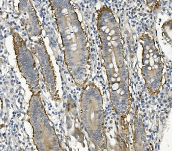 Anti-Integrin beta 4/ITGB4 Antibody