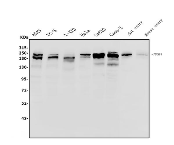 Anti-Integrin beta 4/ITGB4 Antibody
