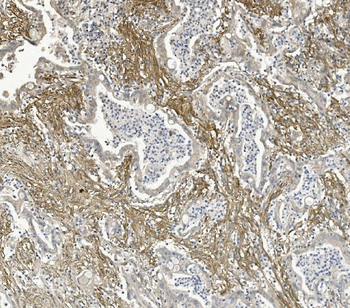 Anti-Integrin beta 5/ITGB5 Antibody