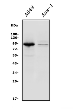 Anti-Integrin beta 5/ITGB5 Antibody