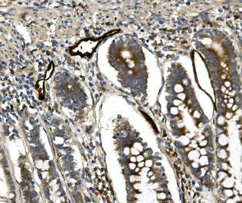 Anti-MAdCAM1 Antibody