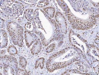 Anti-MCM6 Antibody