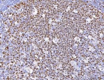 Anti-MCM6 Antibody