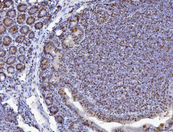 Anti-MCM6 Antibody
