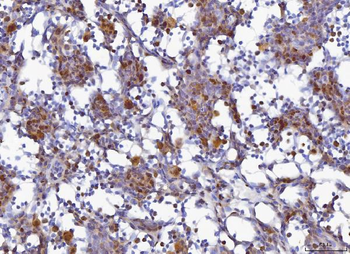 Anti-MCM6 Antibody
