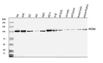 Anti-MCM6 Antibody