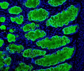 MUC2 Rabbit Polyclonal Antibody