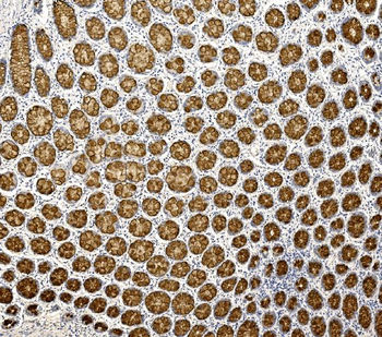 MUC2 Rabbit Polyclonal Antibody