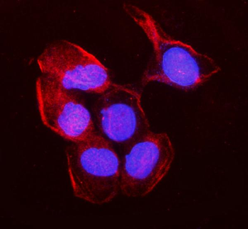 Anti-non-muscle Myosin IIB/MYH10 Antibody