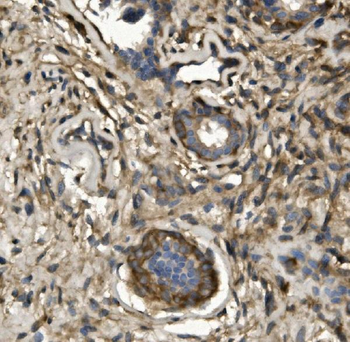 Anti-non-muscle Myosin IIB/MYH10 Antibody