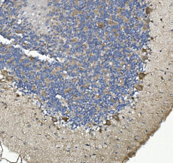Anti-non-muscle Myosin IIB/MYH10 Antibody
