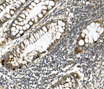 PVRL1/NECTIN1 Antibody