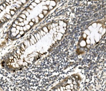 Anti-PVRL1/NECTIN1 Antibody