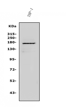 Anti-NFAT5 Antibody