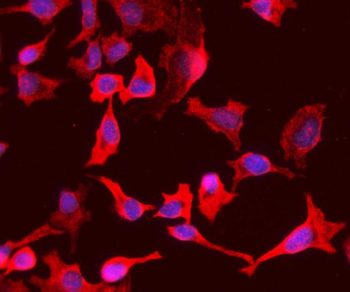 Anti-PCK1/PEPC Antibody
