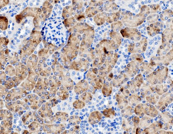 Anti-PCK1/PEPC Antibody