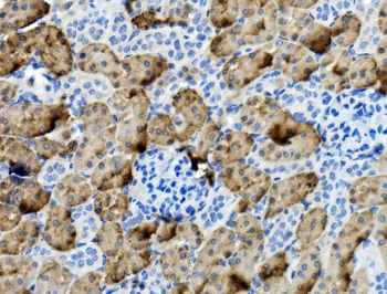 Anti-PCK1/PEPC Antibody