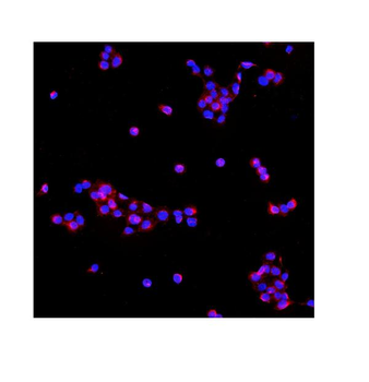 Anti-PDE6 beta/PDE6B Antibody