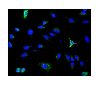 Anti-PDE6 beta/PDE6B Antibody