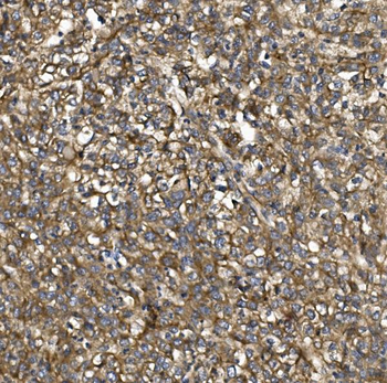 Anti-PDE6 beta/PDE6B Antibody