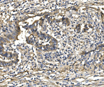 Anti-PDE6 beta/PDE6B Antibody