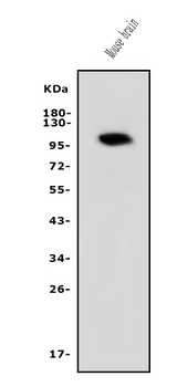 Anti-PDE10A Antibody