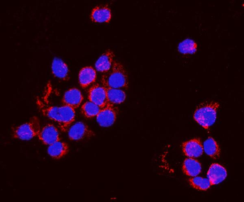 Anti-PNPT1 Antibody