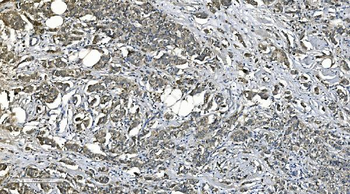 Anti-PNPT1 Antibody