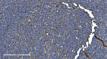 Anti-PNPT1 Antibody