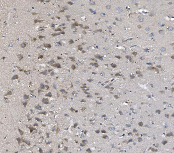 Anti-PNPT1 Antibody