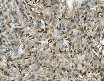 Anti-PRMT8 Antibody