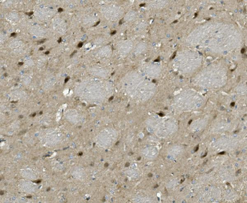 Anti-PRMT8 Antibody