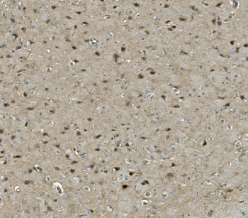 Anti-PRMT8 Antibody