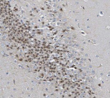 Anti-Rad9b Antibody