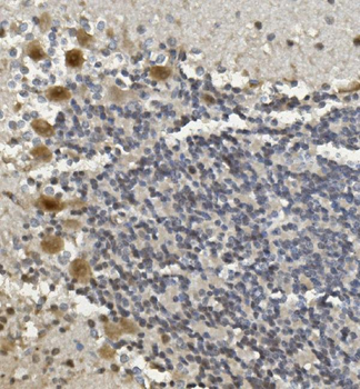 Anti-Rad9b Antibody