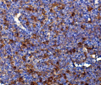 Anti-Rad17 Antibody