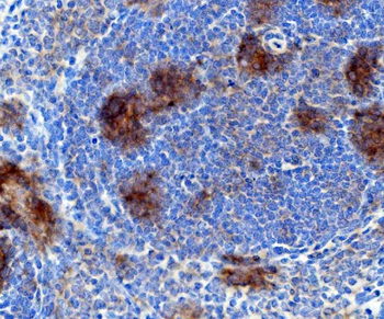 Anti-Rad17 Antibody