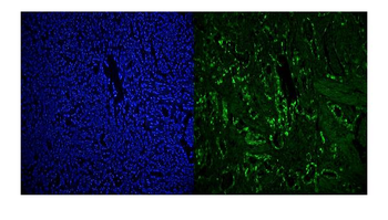 Anti-RCC1 Antibody