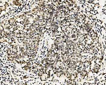 Anti-RCC1 Antibody