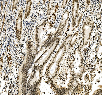 Anti-RCC1 Antibody