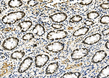 Anti-RCC1 Antibody