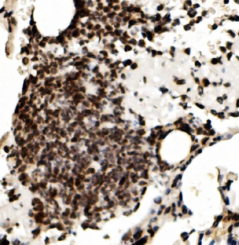 Anti-RCC1 Antibody