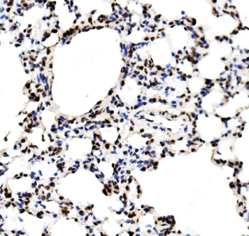 Anti-RCC1 Antibody