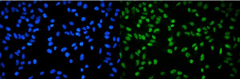 Anti-RPA32/RPA2 Antibody
