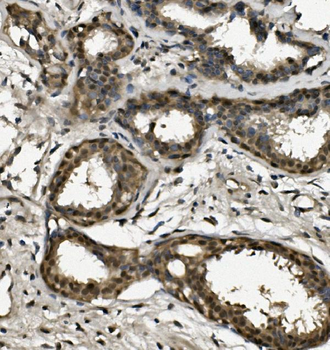 Anti-RPA32/RPA2 Antibody
