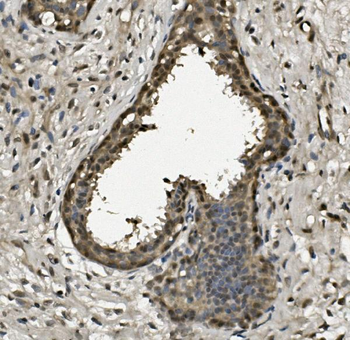 Anti-RPA32/RPA2 Antibody