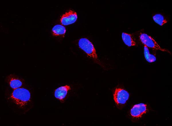 Anti-Nogo A/RTN4 Antibody