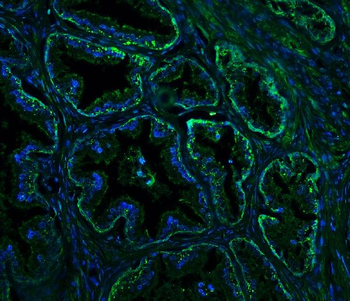 Anti-Nogo A/RTN4 Antibody