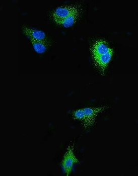 Anti-SGK1 Antibody