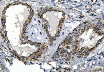Anti-SGK1 Antibody